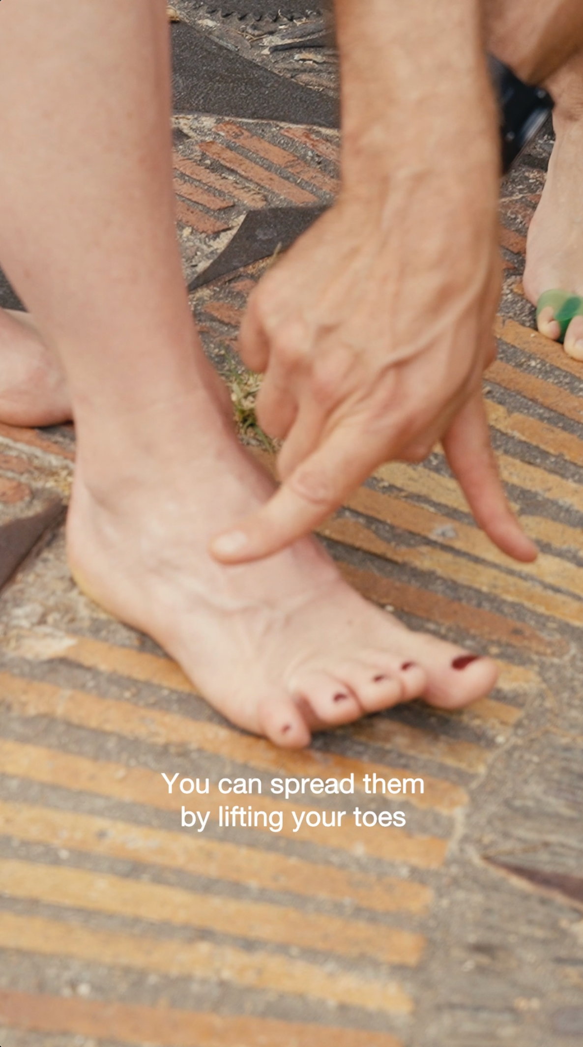 Metatarsalgia: Exercises for Pain Relief in video